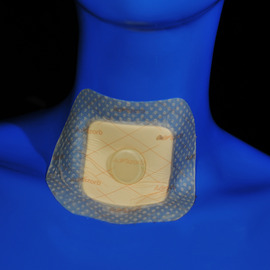 Advazorb Fixation