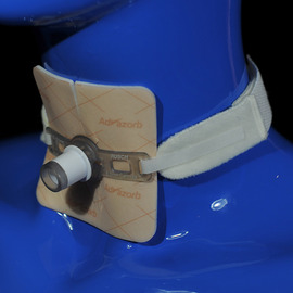 Advazorb 'T' Tracheostomy Dressing
